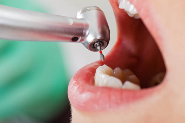 Best Broken or Chipped Tooth Repair in Lake Hiawatha, NJ